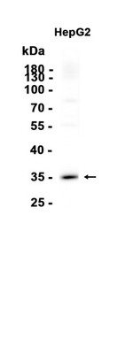 PPA2 Rabbit mAb