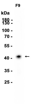 LINE 1 ORF1p Rabbit mAb