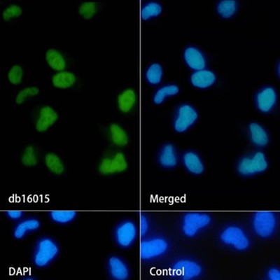 RUNX2 Rabbit mAb
