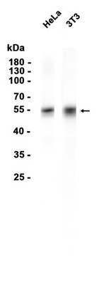 Retinoic Acid Receptor alpha Rabbit mAb
